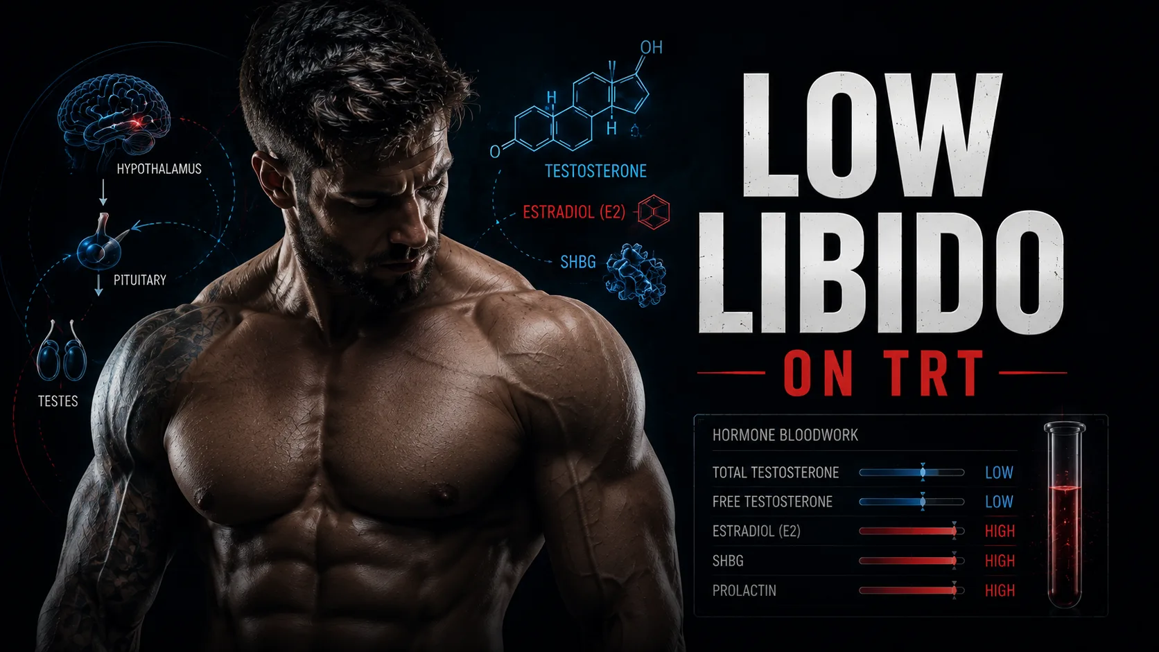 low libido on TRT estradiol prolactin SHBG thyroid causes